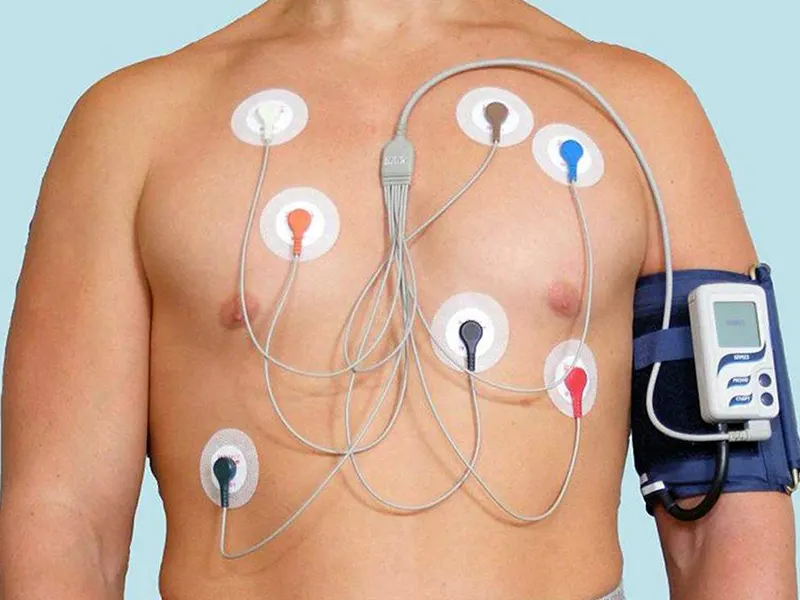 Tansiyon ve Ritim Holter